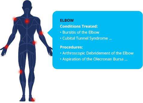 CT Orthopaedic Specialists - Treatment Area Locator